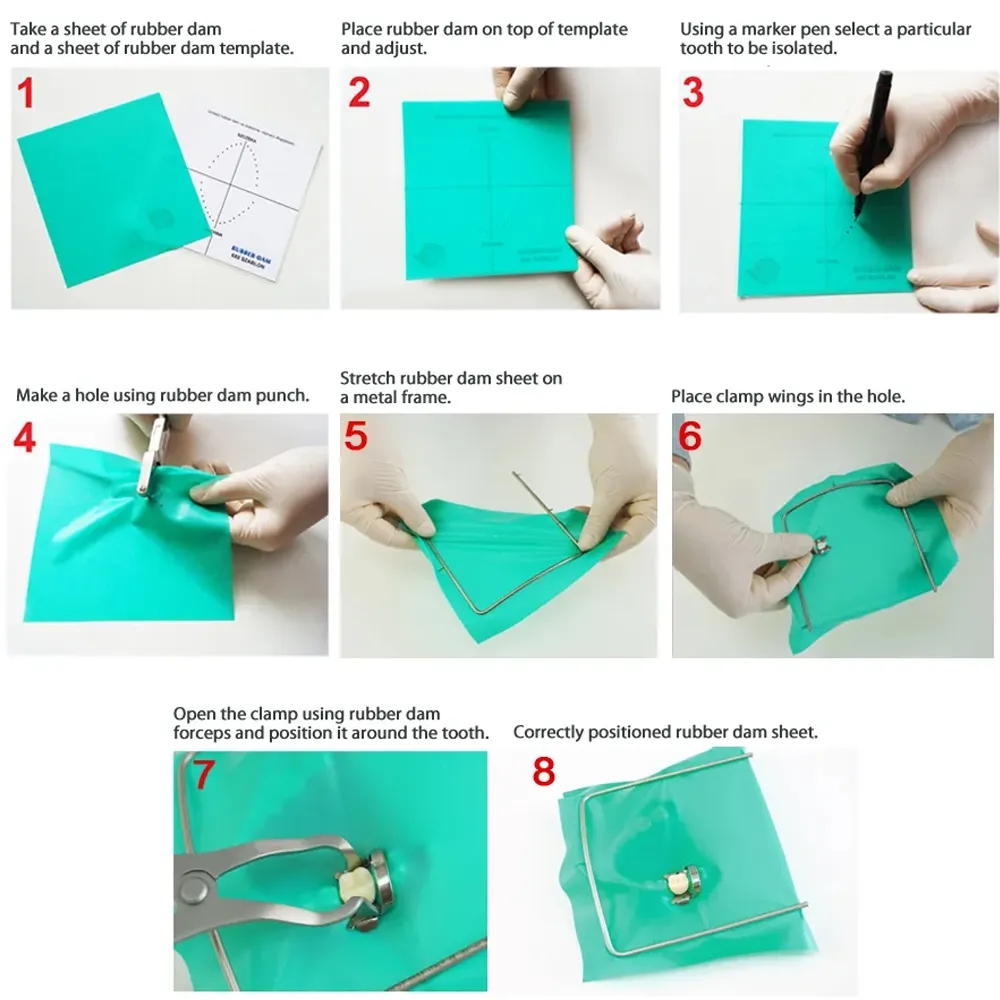 Free Printable Rubber Dam Template